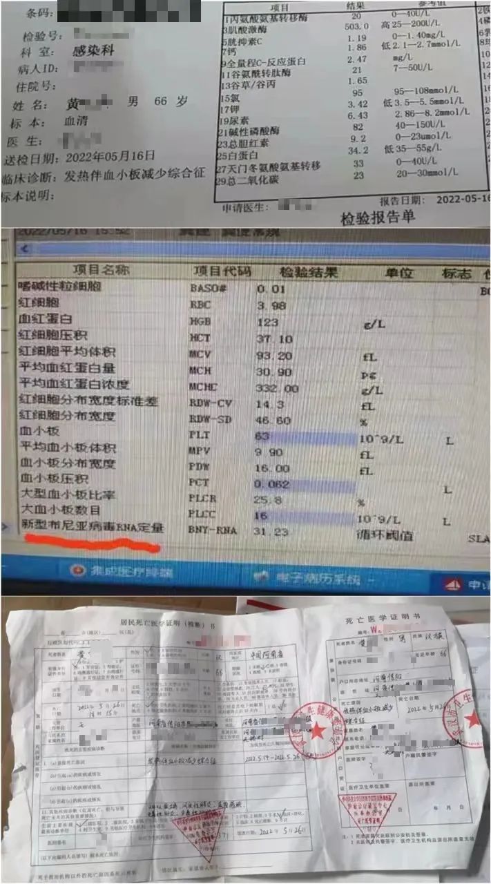 血小板检查报告单图片图片