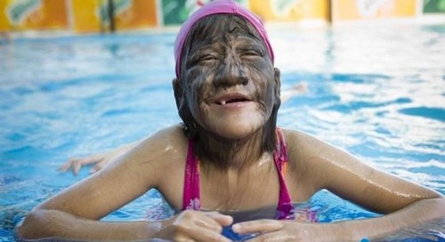 15岁少年54码大脚堪称"脚神" 盘点全球畸形人(图)