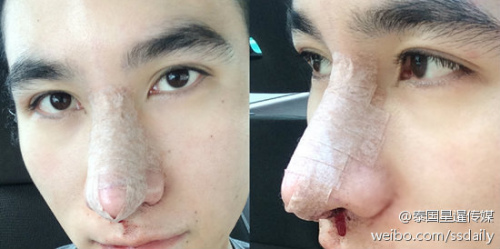 泰国男生整容成功.